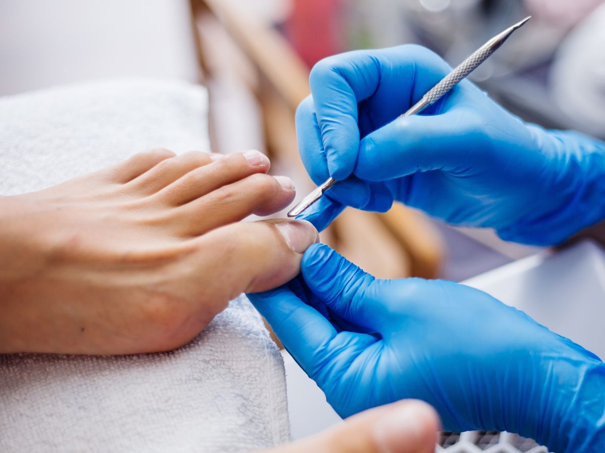 Ingrown Nail Solution Upland: Fast Relief You Can Trust